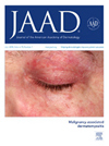 JOURNAL OF THE AMERICAN ACADEMY OF DERMATOLOGY杂志封面